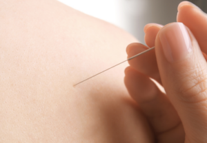 パニック発作パニック障害めまい自律神経鍼上尾ルート治療