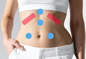 逆流性食道炎非びらん性胃食道逆流症上尾埼玉鍼ルート治療自律神経