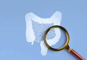 便秘下痢お腹の不調過敏性腸症候群上尾鍼ルート治療自律神経埼玉