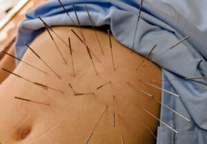 逆流性食道炎上尾埼玉鍼ルート治療自律神経