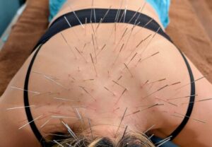 適応障害上尾鍼ルート治療自律神経埼玉